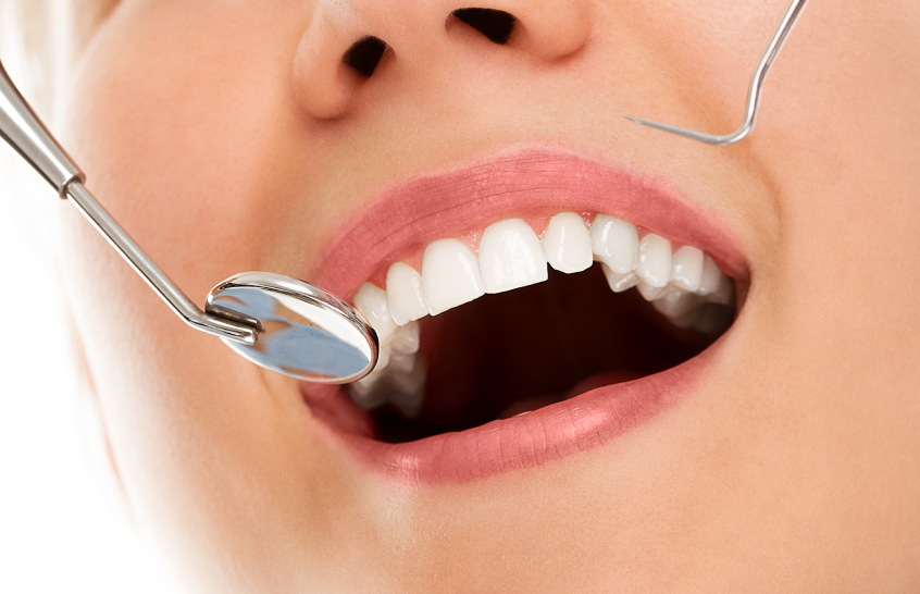 Кейс MediaNation: в 15 раз снизили стоимость лида в VK Рекламе для стоматологической клиники